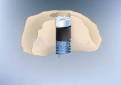 LED-kop Koud Wit Voor Quellstar 600 9 LED-kop Koud Wit Voor Quellstar 600 -Oases Winkel 3 led lights met vervangbare ledkopjes 0 400x283 2